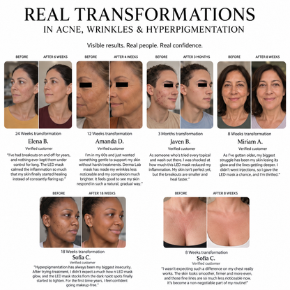 A before-and-after results collage showing six women's faces with text labels for acne, wrinkles, and hyperpigmentation improvements over 24 to 18 weeks. The top header reads 'REAL TRANSFORMATIONS IN ACNE, WRINKLES & HYPERPIGMENTATION' with 'VISIBLE RESULTS.